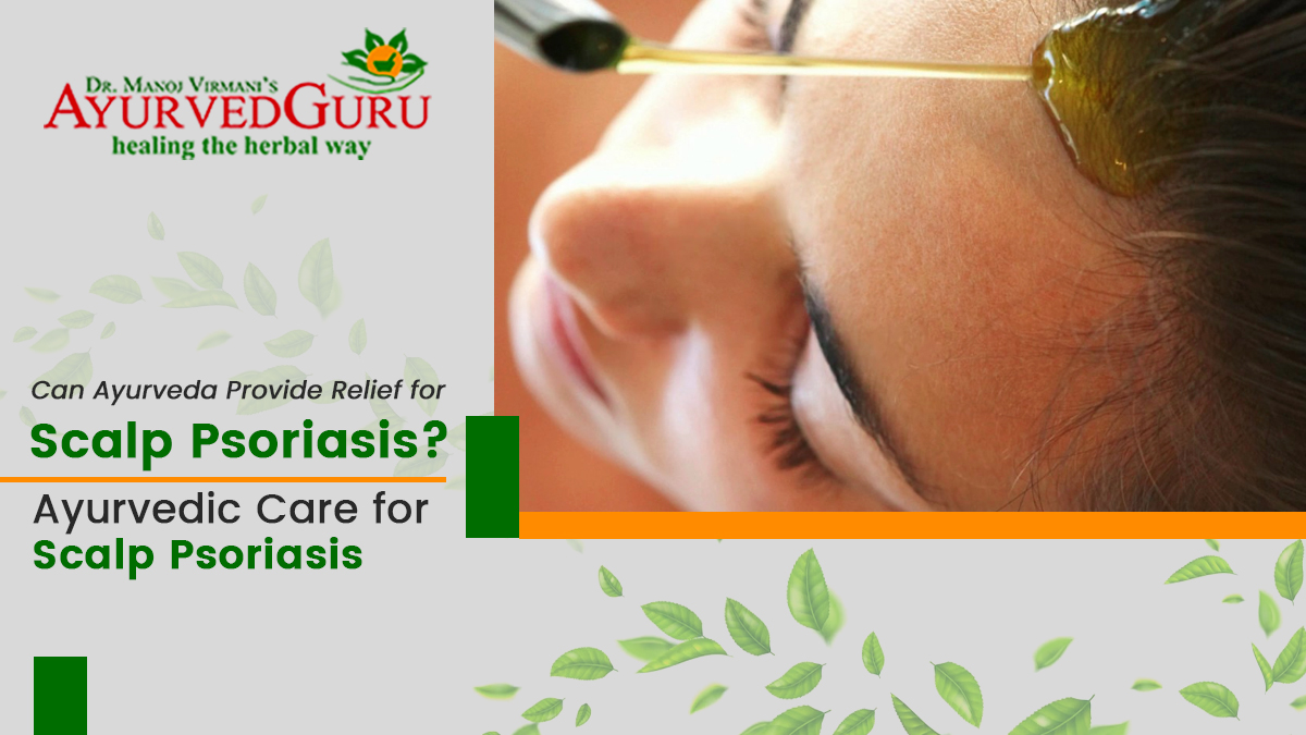 Can Ayurveda Provide Relief for Scalp Psoriasis?