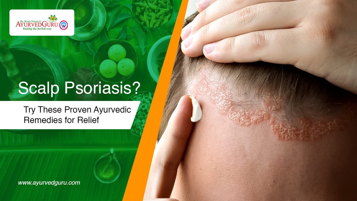 best psoriasis home remedies in Ayurveda