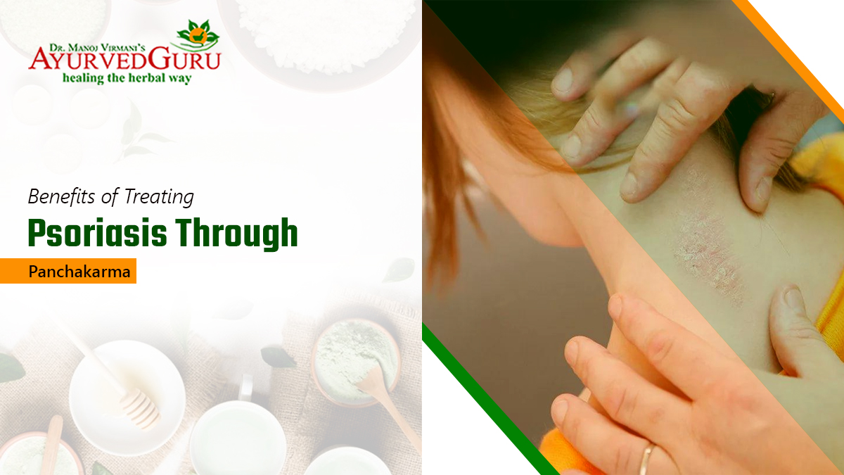 Ayurvedic treatments for psoriasis on the body