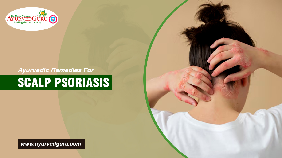 permanent treatment of scalp psoriasis