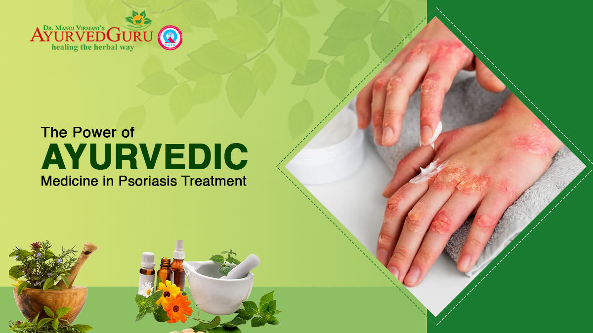 Ayurvedic Medicine in Psoriasis Treatment