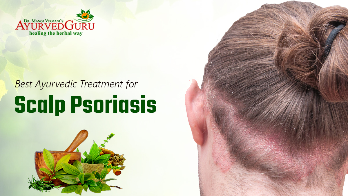 Best ayurvedic treatment for psoriasis on the scalp