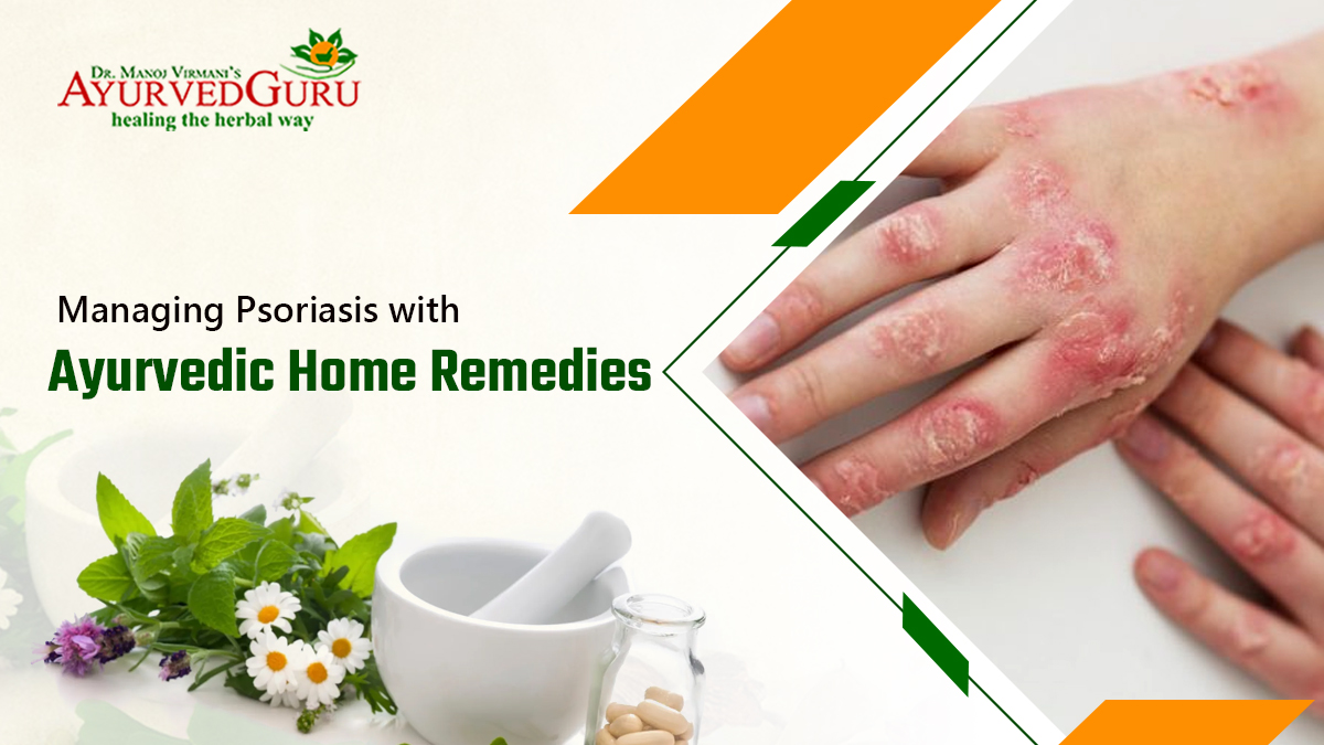 best ayurvedic home remedies for psoriasis