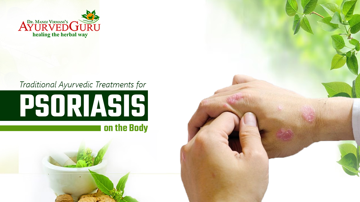 Traditional Ayurvedic Treatments for Psoriasis on the Body