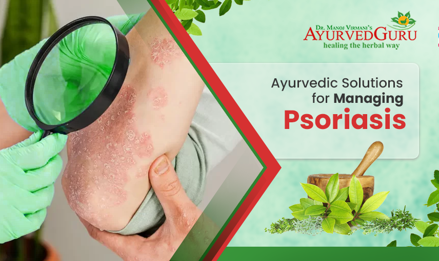 Ayurvedic Solutions for Managing Psoriasis